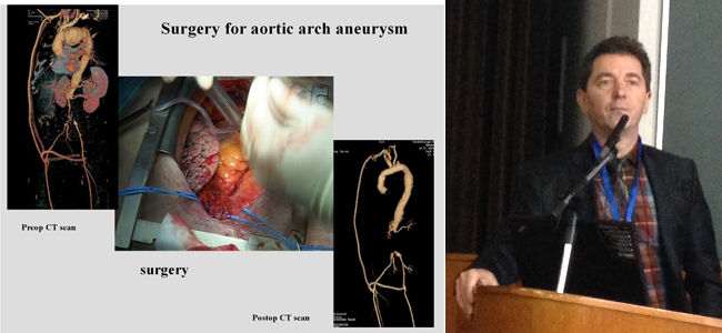Прв балкански митинг за аортна хирургија