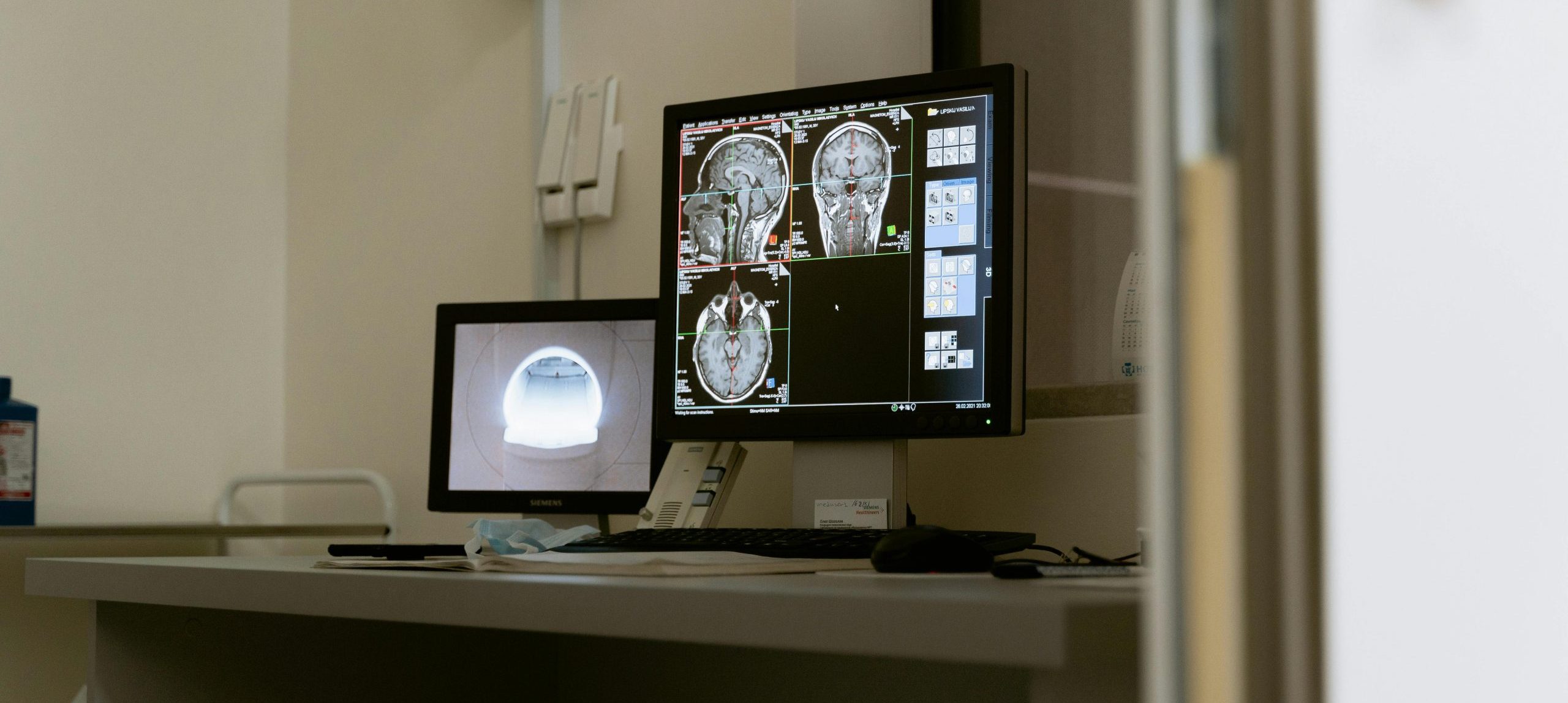 Diagnostikimi me anë të tomografisë së kompjuterizuar (CT)