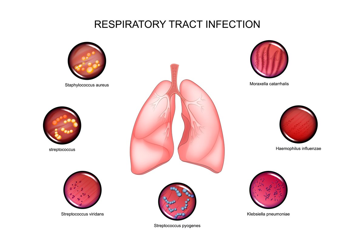 respiratorni-infekcii