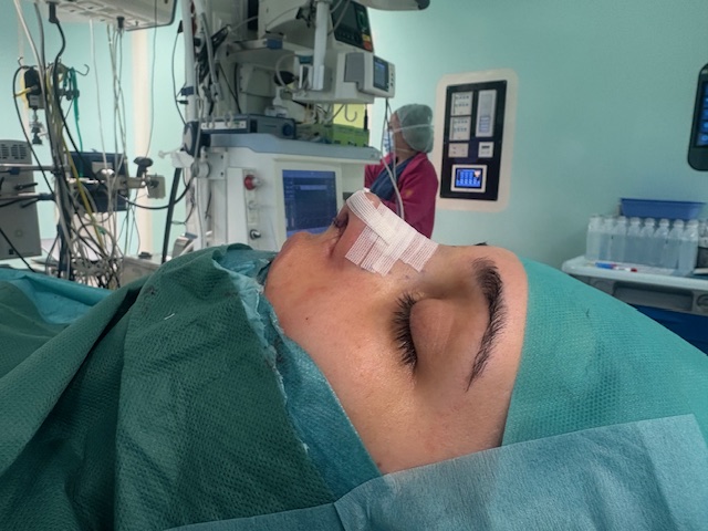 Отворена риносептопластика – ,,Златен стандард,, за решавање на функционални и естетски деформитети на носот