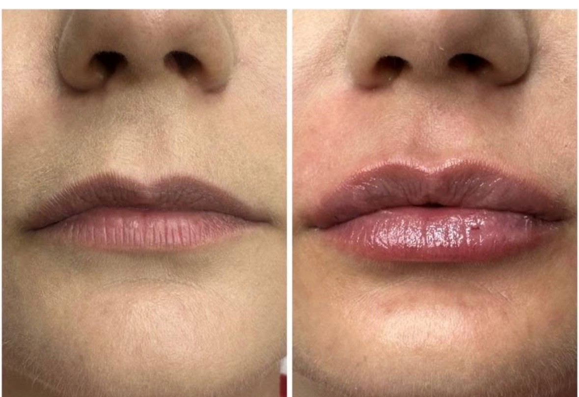 Минимални корекции, за максимален ефект